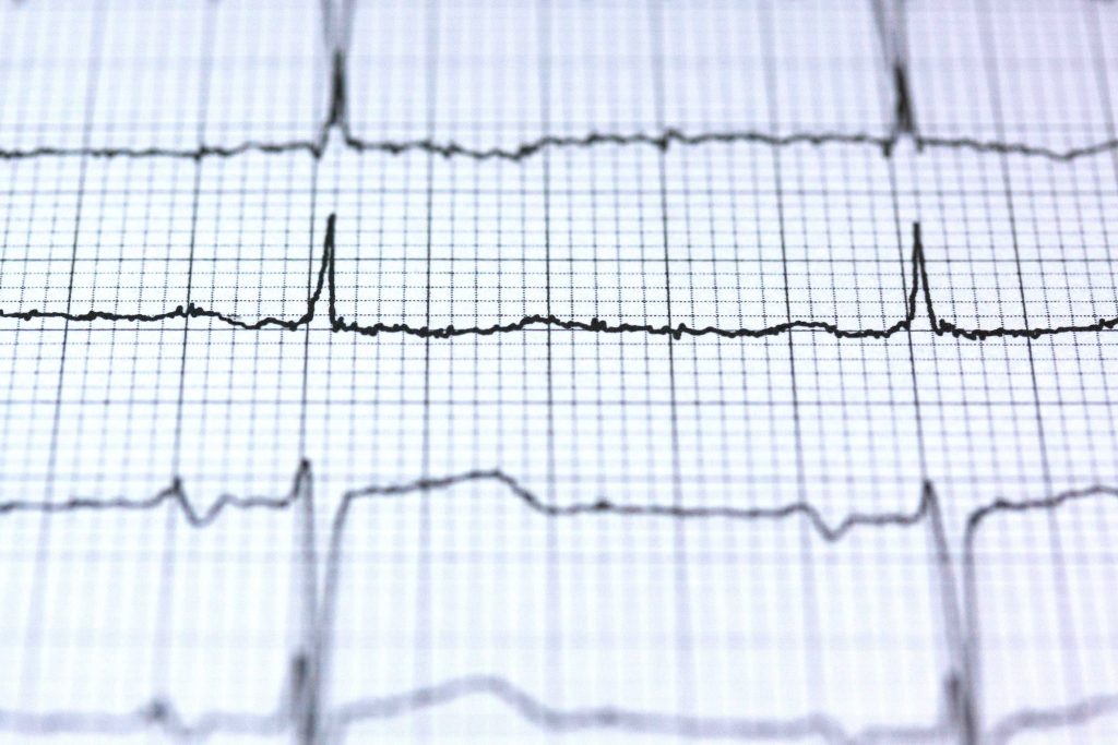 Enhancing ECG Interpretation Through Multi-Modal Integration